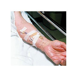 3M Durapore Surgical Tape, 2in x 10 yd (5 cm x 9.14 m), Box Of 6